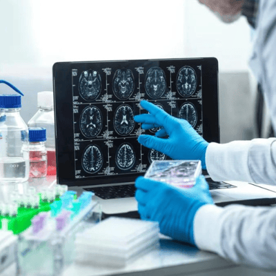 How Medical Imaging is Redefining Healthcare 